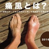 痛風とは？25歳で痛風になった私が死ぬほど痛い初期症状と治療内容を解説